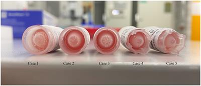 Case report: Side effects of etomidate in propylene glycol in five Göttingen Minipigs